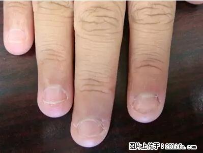 剪指甲、挖耳屎，这些日常小动作竟隐藏大危害！ - 禹州生活资讯 - 禹州28生活网 yuzhou.28life.net